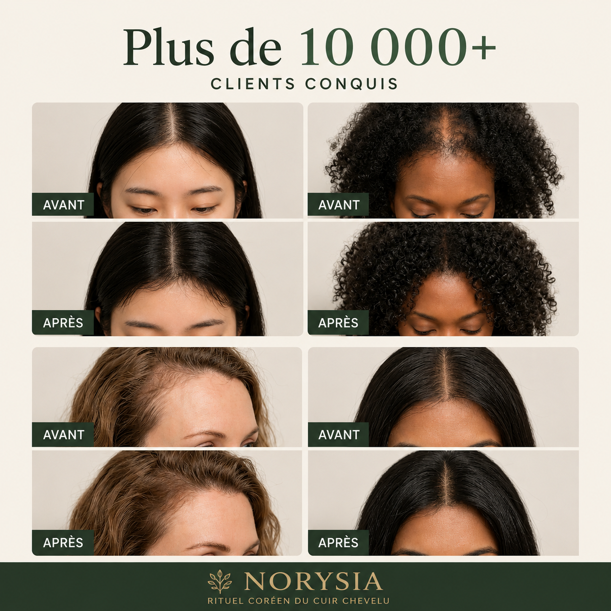 Norysia Rituel Coréen du Cuir Chevelu™